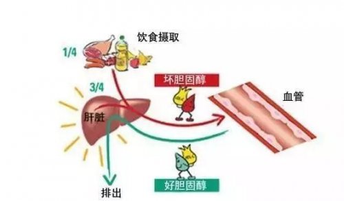 口服叶酸治疗高胆固醇血症相关的血管生成障碍