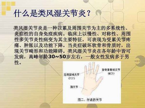 叶酸作为甲氨蝶呤的补充用于类风湿关节炎的预防和治疗