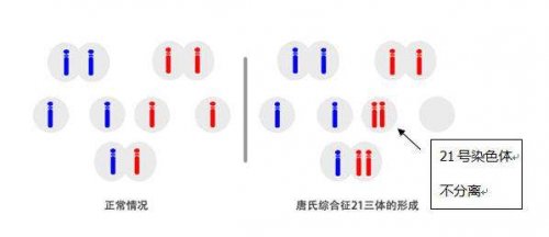叶酸代谢异常和亚甲基四氢叶酸还原酶基因突变可能是唐氏综合征的母亲危险因素