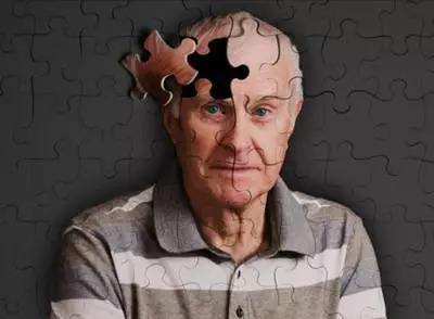同型半胱氨酸和叶酸是痴呆和阿尔茨海默病的危险因素